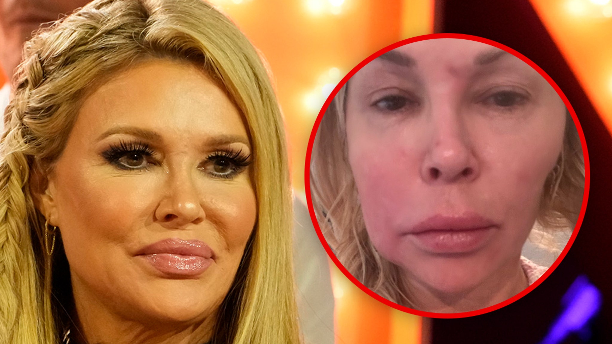 Brandi Glanville admits she hasn't had sex in over a year because of facial problems