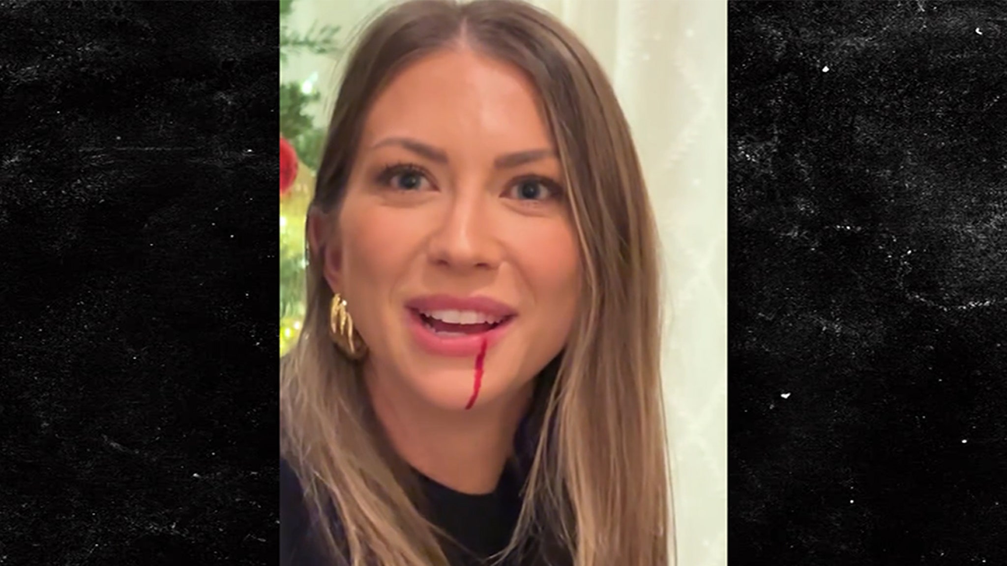 Stassi Schroeder left dripping blood after a “nasty” punch to the face