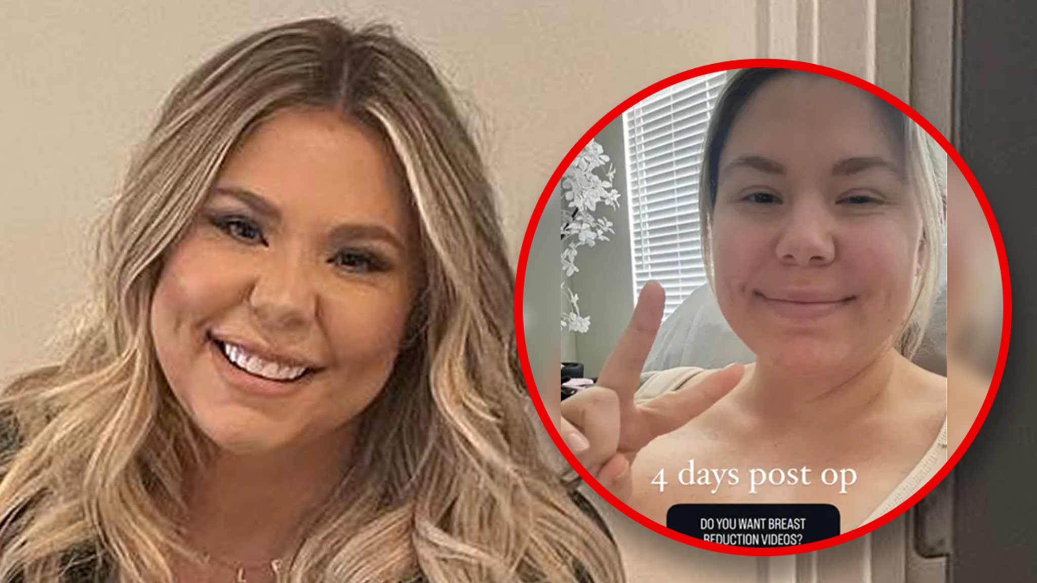 “Teen Mom” star Kailyn Lowry reveals she has had a breast reduction