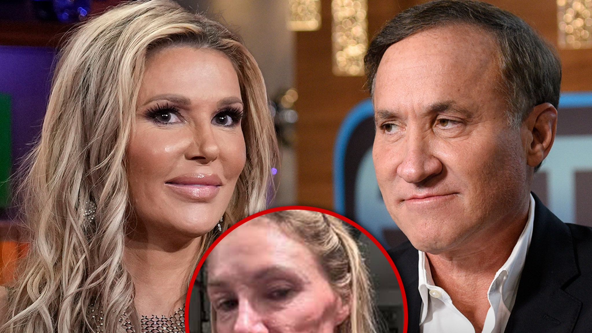 Brandi Glanville to get by Dr. Terry Dubrow for a mysterious illness of an operation