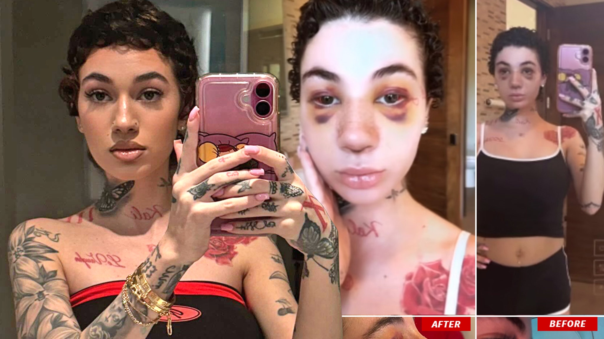 Bhad Bhabie shows off her nose job and reveals what type of cancer she has