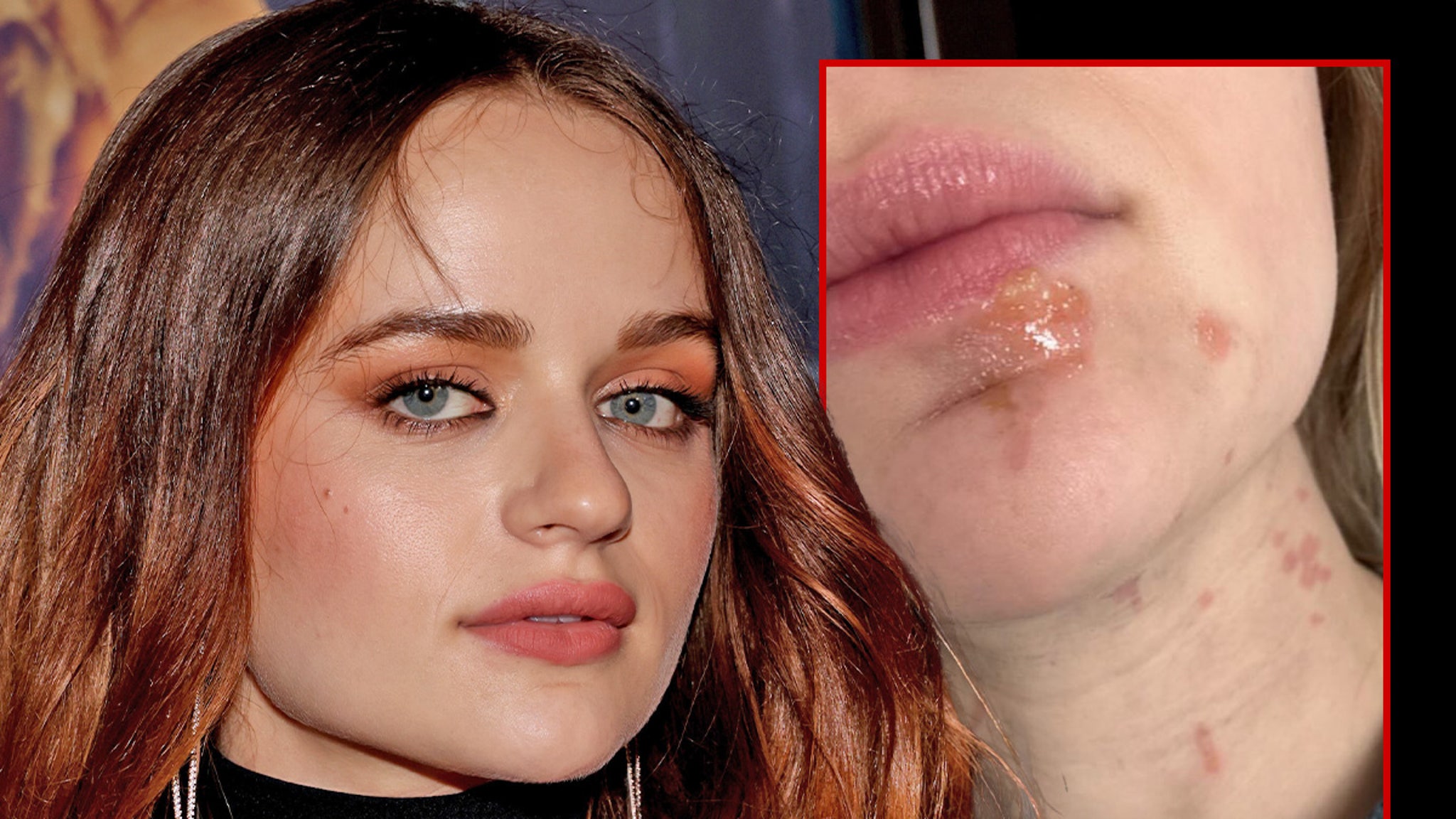 Joey King ends with facial burns when cooking shallots in hot oil