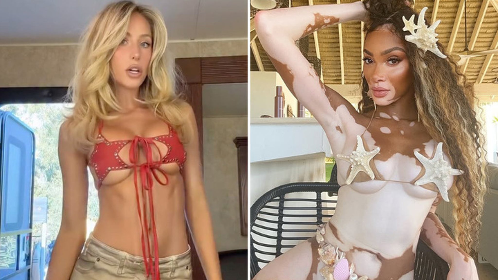 Alix Earle against Winnie Harlow, who would you prefer?!