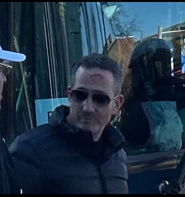 The general manager of Eagles Howie Roseman injured in the Super Bowl parade after being hit by a beer can