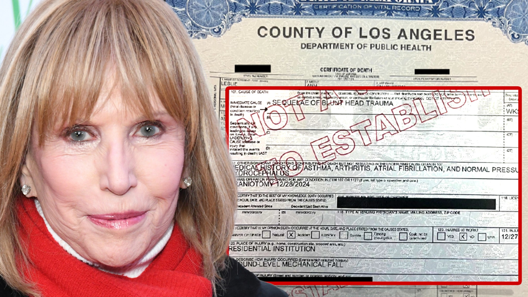 The cause of death of the General Hospital Leslie Charleson's cause of death reveals