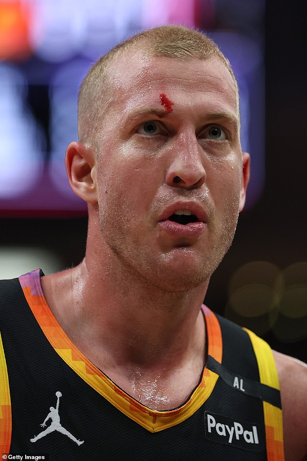 The NBA Estrella Mason Plumlee was bloody after a chaotic fight with Steven Adams in Suns' Rockets game