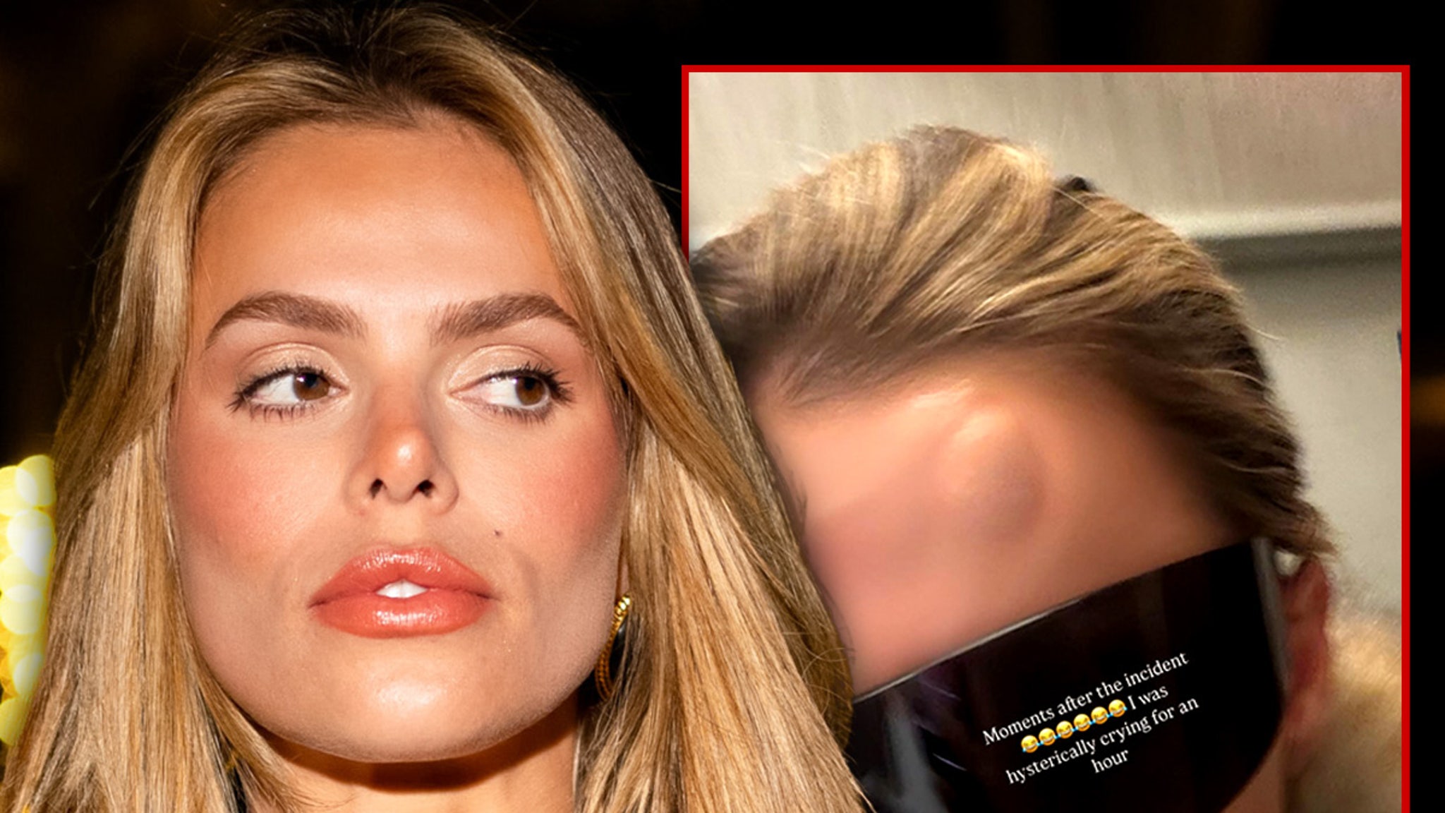 Brooks Nader shows a large bump on her forehead after she has gone into the door